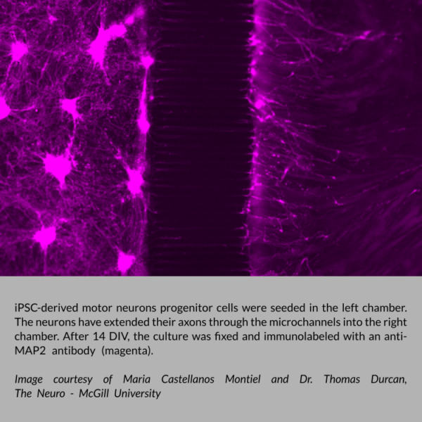 iPSC-derived motor neurons progenitor cells were seeded in the left chamber of eNUVIO's OMEGA neuronal microfluidic co-culture and compartmentalization device. The neurons have extended their axons through the microchannels into the right chamber. After 14 DIV, the culture was fixed and immunolabeled with an anti-MAP2 antibody (magenta). Image courtesy of Maria Castellanos Montiel and Dr. Thomas Durcan, The Neuron - McGill University