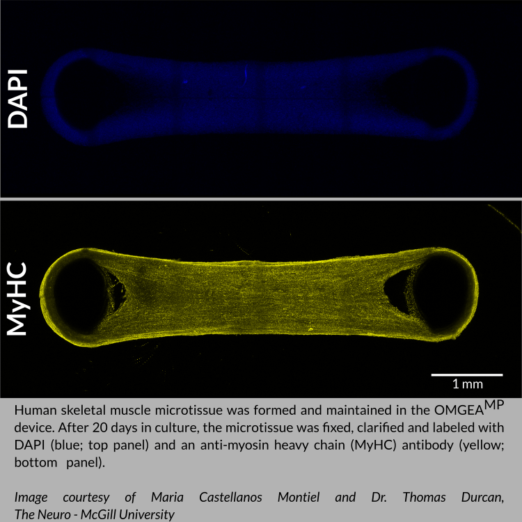 Human skeletal muscle microtissue was formed and maintained in eNUVIO's OMEGA-MP 3D skeletal muscle culture device. After 20 Days, the microtissue was fixed, clarified and labeled with DAPI (blue; top) and anti-myosin heavy chain antibody (MyHC; yellow, bottom). Image courtesy of Maria Castellanos Montiel and Dr. Thomas Durcan, The Neuro - McGill University