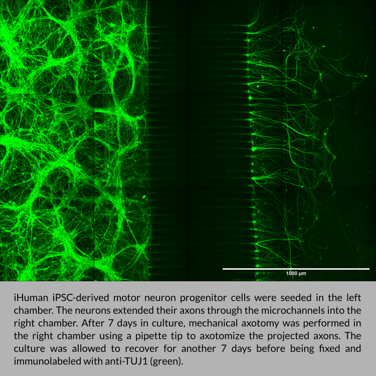 Human iPSC-derived motor neuron progenitor cells were seeded in the left chamber of the OMEGA device by eNUVIO. The neurons extended their axons through the microchannels into the right chamber. After 7 days in culture, mechanical axotomy was performed in the right chamber using a pipette tip to axotomize the projected axons. The culture was allowed to recover for another 7 days before being fixed and immunolabeled with anti-TUJ1 (green).